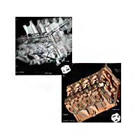 Компьютерная томография