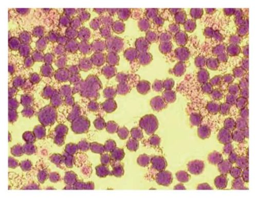 Edvotek Морфология раковых клеток Морфология раковых клеток:Образование | Фишер Сайентифик