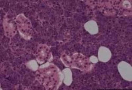 Препараты тканей околоушной железы Novus Biologicals (нормальные) Препараты тканей околоушной железы | Фишер Сайентифик