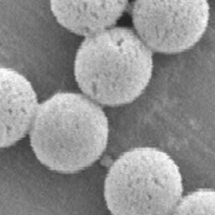 Streptavidin coated particles