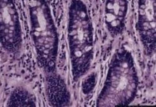 Novus Biologicals Препараты тканей прямой кишки (обычные) Препараты тканей прямой кишки (обычные):Образование | Фишер Сайентифик