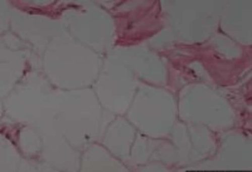 Слайды тканей липомы кожи Novus Biologicals™ (опухоль)