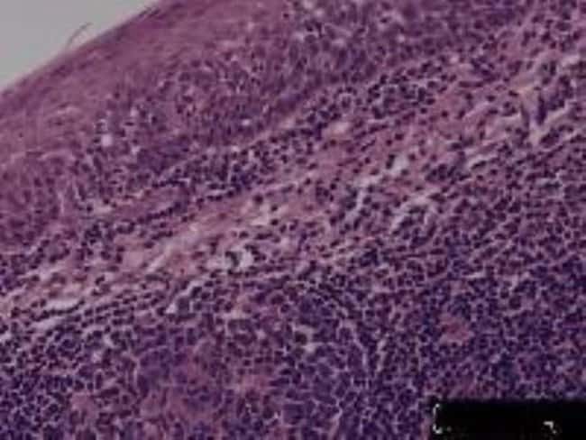 Препараты тканей миндалин Novus Biologicals (обычные) Препараты тканей миндалин (обычные):Образование | Фишер Сайентифик