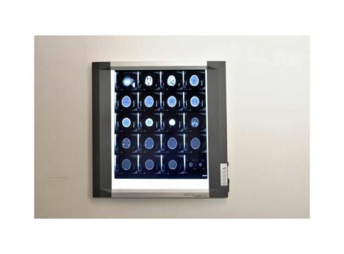 Bio-x X-Ray View Box Single Screen High End Version