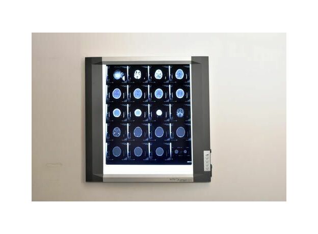 Bio-x X-Ray View Box Single Screen High End Version