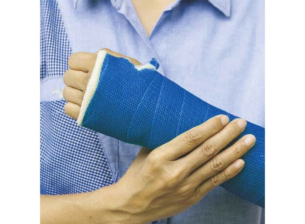 Лента Dynamic Nova Cast из стекловолокна (10 шт. в упаковке)