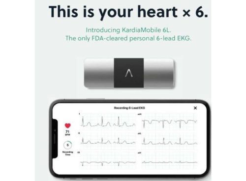ALIVECOR 6L ECG