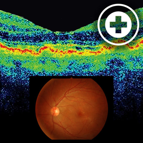 Медицинские волокна
