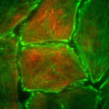 Набор аксессуаров Infinity TIRF