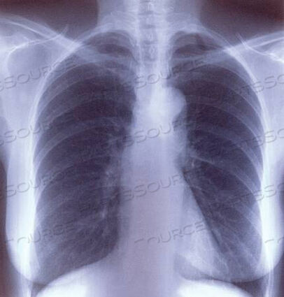 OEM#: EK8DGCLEAR CHOICE™ PERFORMANCE РЕНТГЕНОВСКАЯ ПЛЕНКА (100 В КОРОБКЕ) от McKesson