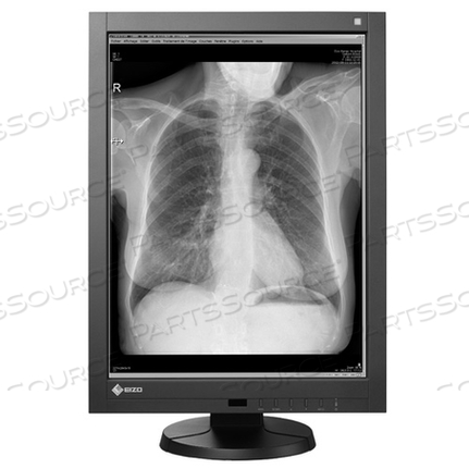 RADIFORCE 3MP MONO SINGLE HEAD BUNDL С 1X ДИСПЛЕЕМ GX340 И 1X ВИДЕОКАРТОЙ NVIDIA QUADRO K2000