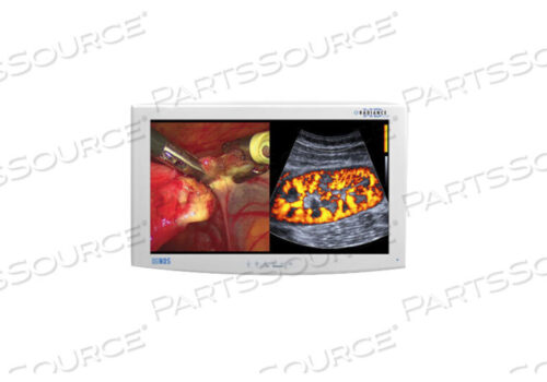 РЕМОНТ - ДИСПЛЕЙ NDS RADIANCE