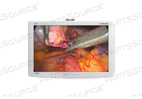 РЕМОНТ - ДИСПЛЕЙ NDS ENDOVUE