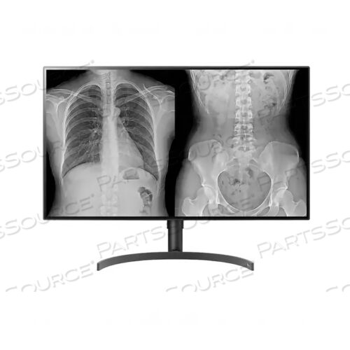 31,5 8-мегапиксельный ДИАГНОСТИЧЕСКИЙ ДИСПЛЕЙ